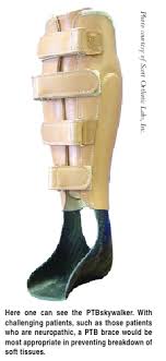 Comfortable ¼ polyethylene foam lines anterior shell. Keys To Conservative Care For Adult Acquired Flatfoot