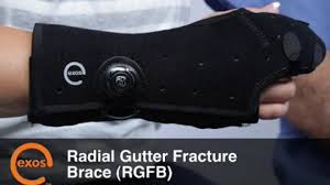 Image result for Radial Gutter Cast