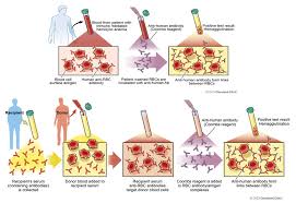 Image result for Indirect Coombs