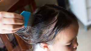 Avoir chacun son propre matériel pour se coiffer (brosse, peigne.) Tous Les Endroits Ou L On Peut Attraper Des Poux Sans Le Savoir Femme Actuelle Le Mag
