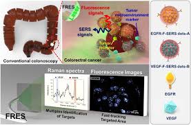 It is then gently passed through the large bowel until it reaches the junction of the small and large intestines. Simultaneous Detection Of Egfr And Vegf In Colorectal Cancer Using Fluorescence Raman Endoscopy Scientific Reports