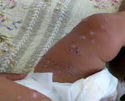 Get your questions about the vaccine answered starting. C8vy6jz 0c Vm