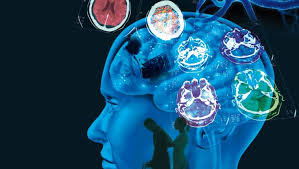 Check spelling or type a new query. Conoce Los Sintomas De La Esclerosis Multiple Prensa Libre
