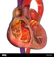 Image result for Cor Pulmonale