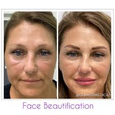 Deanna Filomena, 7521 Courtyard Run E, Boca Raton, FL 33433, US