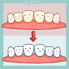 Cuci gigi (scaling) klinik kerajaan bayar rm 2?? 6 Best Teeth Whitening In Klang Price Guide Reviews