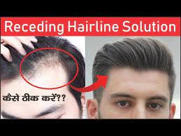 Why does hair fall out? How To Fix Receding Hairline And Hair Fall Receding Hairline Solution Youtube