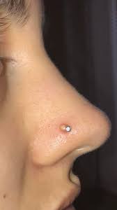 Got My Nose Pierced Around 6 Weeks Ago And Developed A Small Bump 3 Weeks After Went To My Piercer And They Told Me It S A Keloid But It Now Contains Pus