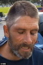 San Francisco man sues after a PINE CONE falls