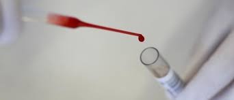 Tumor markers are chemicals produced by cancer cells and found in the blood. This New Blood Test Could Revolutionise Early Screening For Cancer World Economic Forum