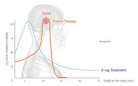This precisely targeted option offers fewer side effects and a brighter quality of life. Smc News About Smc Samsung Medical Center