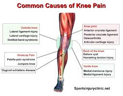 Pin On Sports Med