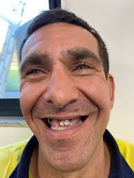 A NEW SMILE FOR JEROME! Today Jerome has completed one of several dental  appointments that have given him the end result he could only dream of