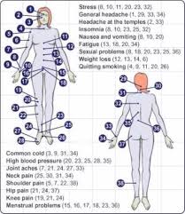 Trigger Points Chart Web Site Designed Hosted At Homest