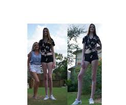She's 6 feet 9 inches tall, and her legs alone are 53 inches — surpassing the previous record holder by almost a full inch. Meet Maci Currin The 17 Year Old Who Has World S Longest Female Legs
