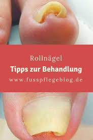rollnagel und ihre behandlungsmoglichkeiten fusspflegeblog behandlung aloe vera haut schonheitsbehandlungen
