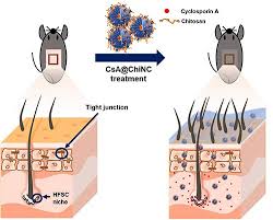 Looking for the best hair growth products? A Novel Chitosan Nanocapsule For Enhanced Skin Penetration Of Cyclosporin A And Effective Hair Growth In Vivo Springerlink