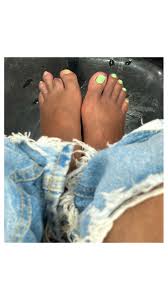 Image result for toe amputation