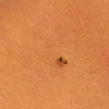 Wenn es sich die kleinen tiere bereits in der matratze gemütlich gemacht haben, hilft eine professionelle matratzenreinigung. Lerne Diese Speckkafer Larve Im Bett