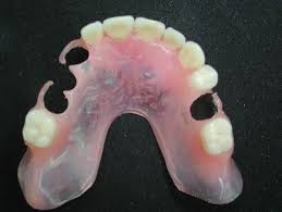 Maybe you would like to learn more about one of these? Dentures Buckden Dental Clinic Cambridgeshire Dentists St Neots And Buckden