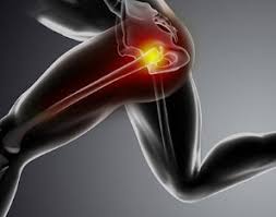 From a standing position on your left foot, hinge forward from your hips keeping your back flat and right leg in straight behind it, and core braced. Proximal Hamstring Tendon Tears A Common Cause Of Hip Pain