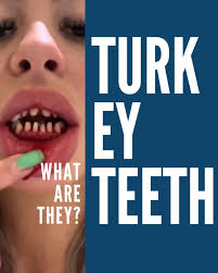 CONGRATULATIONS!!! to our very own Tracey Mahon!! Well done you! So proud  😁🦷