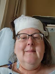On August 28th 2025 I had a seizure that sent me to the St Vincent's in  downtown Birmingham. I was diagnosed with a meningioma and was told I have  this ping pong