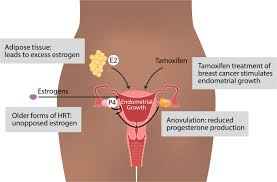 Learn uterine cancer symptoms, signs, prognosis, survival rate, stages, and treatment. Estrogen Signaling In Endometrial Cancer A Key Oncogenic Pathway With Several Open Questions Springerlink