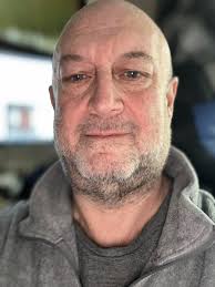 Kidney Transplants Before and After