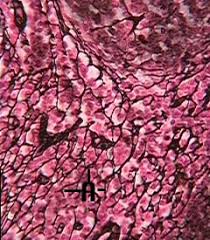 Reticular fibers are synthesized by special fibroblasts called reticular cells. Connective Tissue Aandpeasyaspanda