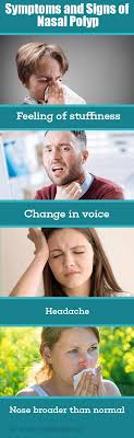 Nasal polyps (np) are noncancerous growths within the nose or sinuses. Nasal Polyp Causes Symptoms Diagnosis Treatment Health Tips