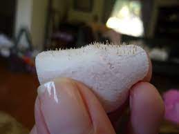 If you aren&#x27;t careful, peeling off that pore strip could result in redness and irritation. Biore Gunk4 Diy Pore Strips Pore Strips Pores Diy