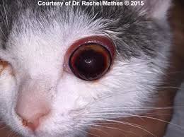 Image result for Proptosis