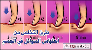 We did not find results for: Ø¹Ù„Ø§Ø¬Ø§Øª ØªÙ‚Ù„ÙŠØ¯ÙŠØ© Ù„ØªÙˆØ±Ù… Ø§Ù„Ù‚Ø¯Ù…ÙŠÙ† ÙˆØ§Ù„ÙƒØ§Ø­Ù„ÙŠÙ† ØªØ¹Ø±Ù Ø¹Ù„ÙŠÙ‡Ø§ Ø¹Ù„Ø§Ø¬ Ø§Ø­ØªØ¨Ø§Ø³ Ø§Ù„Ø³ÙˆØ§Ø¦Ù„ ÙÙŠ Ø§Ù„ÙƒØ§Ø­Ù„