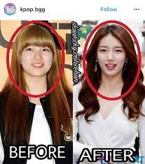 Before and after alleged plastic surgery 1. Beau On Twitter Bae Suzy Before And After Plastic Surgery Kpop Kidol Missa Leeminho
