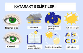Katarakt Ameliyati Fiyatlari Prof Dr Gokhan Gulkilik