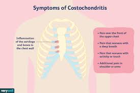 Anatomy of right side of back of rib cage : Costochondritis Overview And More