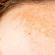 Black dots on a map usually represent cities. 3 Top Reasons You Have Dark Spots On Your Face Eminence Organic Skin Care