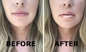 Softening and creamy with staying power. This Kardashian Beauty Lip Gloss Is A Gamechanger Hellogiggles