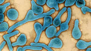 Get the facts on the history, symptoms, and treatment of marburg virus disease, formerly known as marburg. M316sur5zhfcom