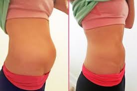 These Pictures Of Me Were Taken Just 4 Hours Apart Bloating Is Something That I Used To Dea Digestion Remedy Home Remedies For Bloating Bloating Remedies