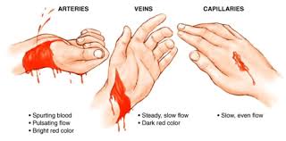 First Aid Tip 💡: Types of bleeds ...