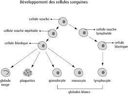 La fréquence des leucémies aiguës est faible (environ 1/100 000 habitants). Qu Est Ce Que La Leucemie Aigue Lymphoblastique Societe Canadienne Du Cancer