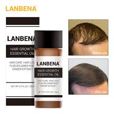 It's a pill you take once a day, and it can slow down hair loss and stimulate new hair. Fast Hair Growth Products Best Hair Products For Men Hair Pomade Best Hair Gel For Men Make Your Hair Grow Faster Biotin For Hair Loss Pomade For Men Emporiaz