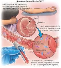Noninvasive Prenatal Testing Prenatal Testing Prenatal Prenatal Development