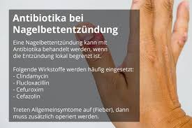 Wann Sind Antibiotika Bei Einer Nagelbettentzundung Notwendig