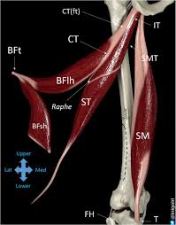 Many tears do not completely sever the tendon. Sonographic Landmarks In Hamstring Muscles Springerlink