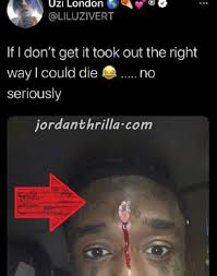 Lil uzi vert has removed the $24m (approximately £17m) diamond that was implanted in his forehead, three months after unveiling the ostentatious accessory. Lil Uzi Vert Could Die After Pink Diamond Implant Causes Serious Injury Making His Forehead To Bleed Jordanthrilla