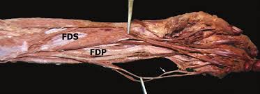 It hurts, not just when you lift or exercise, but also when you do everyday tasks, even something as basic as typing or moving the mouse on your computer. Anterior Aspect Of The Left Forearm Fds Fl Exor Digitorum Super Download Scientific Diagram