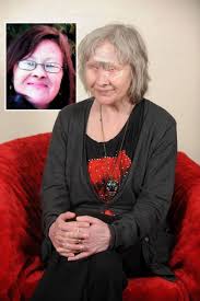 Wendy Hamriding: My dog ate my face and left me blind… but saved my life